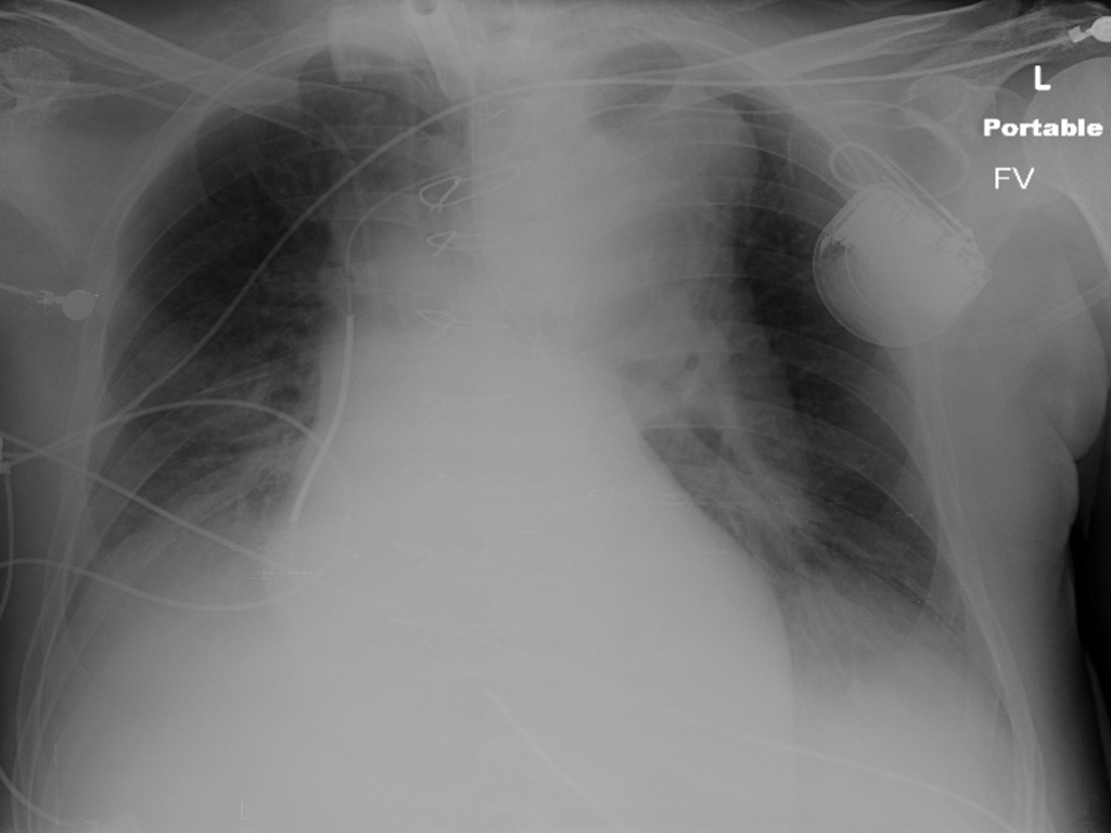 A Night In A Level One Trauma Center - Uncle Jimmy Radiology